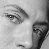 FINE LINES & WRINKLES